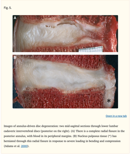 Adaptation of the Intervertebral Disc